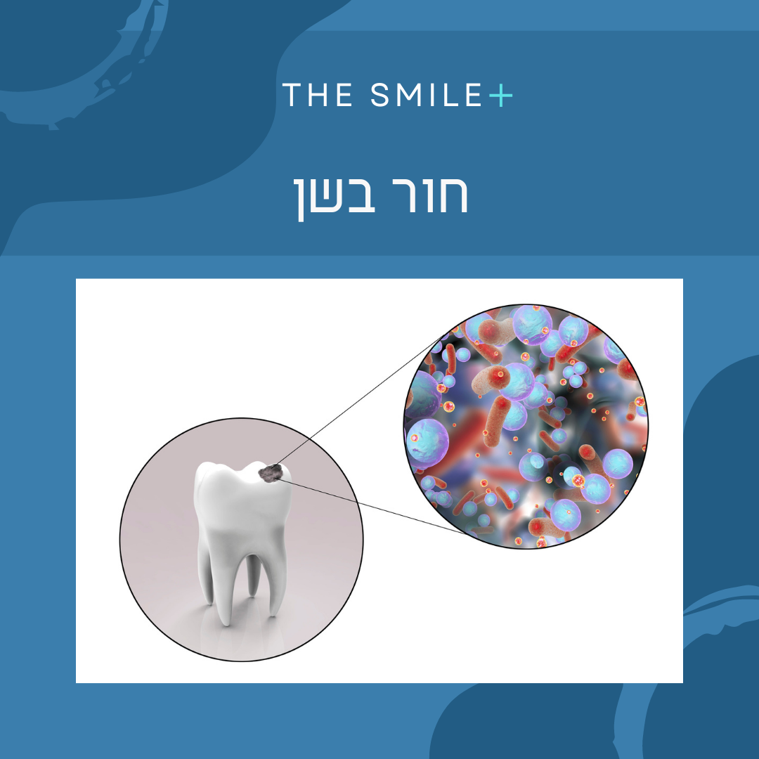 חור בשן - מה זה, איך זה ומה לעשות בנושא
